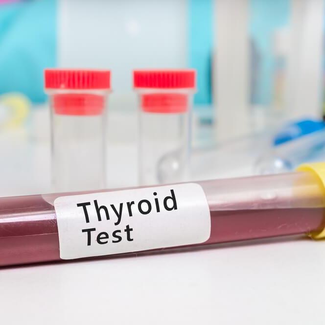 blood-in-tube-thyroid-test